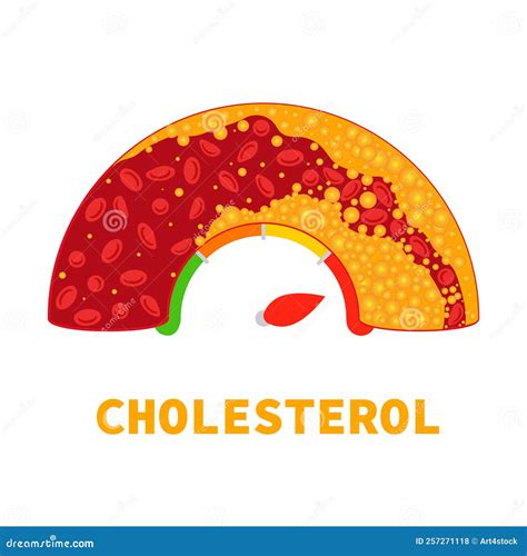 Cholesterol Level Meter Gauge with Blood Vessel Diagram Stock Vector ...