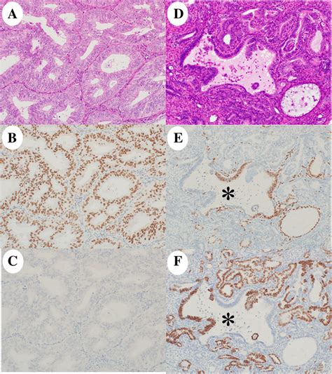 Histology and immunohistochemistry of the initially diagnosed tumor.... | Download Scientific ...