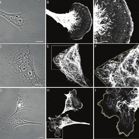 (PDF) Vimentin organization modulates the formation of lamellipodia