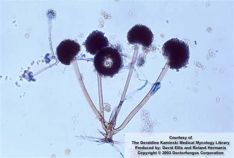 Rhizopus Phylum Zygomycota | bio | Pinterest | Google search, Microbiology and Electron microscope