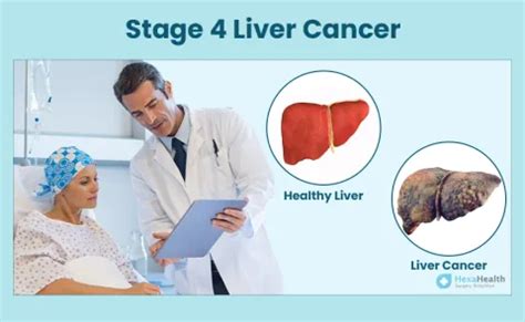 Stage 4 Liver Cancer: Symptoms, How Long to Live