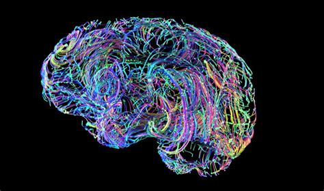 Machine Learning Turns Brain Scans Into Cellular-Level Data - Asian ...