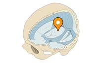 Tentorial notch - e-Anatomy - IMAIOS