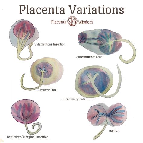 "Placenta Variation Watercolour Drawings" by placentawisdom | Redbubble