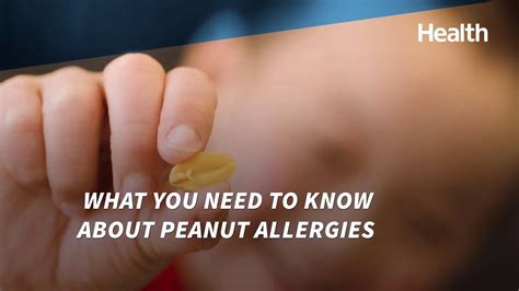 What You Need to Know About Peanut Allergies | Health - YouTube