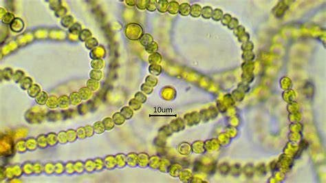 Nostoc Microscope