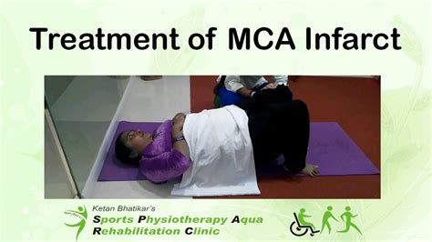 Treatment of MCA Infarct - YouTube