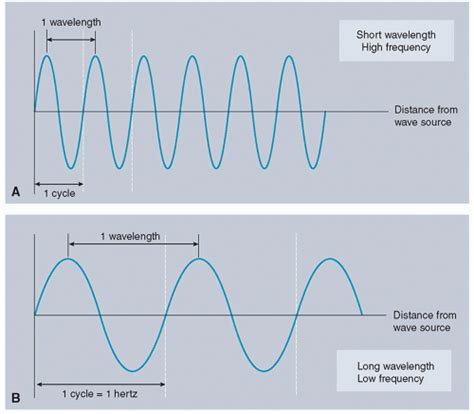 Ultrasound Imaging | Radiology Key