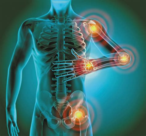 What is chronic inflammation? - Harvard Health