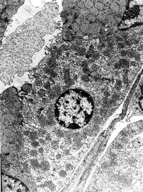 Histology EM4 Oxyntic Cell Diagram | Quizlet