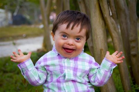 What is Down Syndrome? - Shreeansh- Fetal medicine center