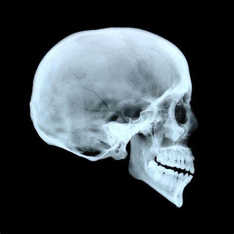 Adult Human Skull Photograph by D. Roberts