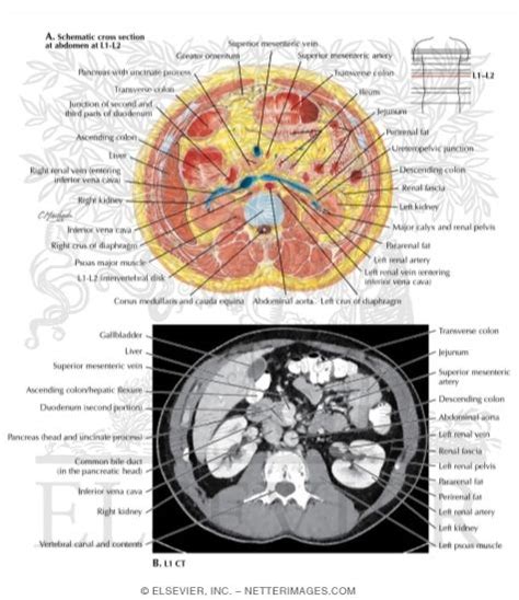 Cross Section at L1-L2 With CT