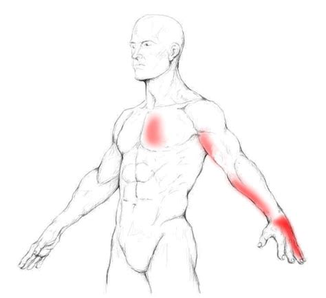 Serratus posterior superior pain & trigger points