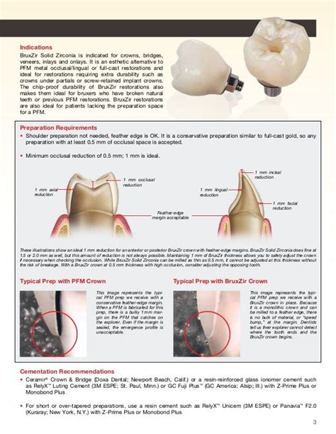 Cementation of Zirconia crowns