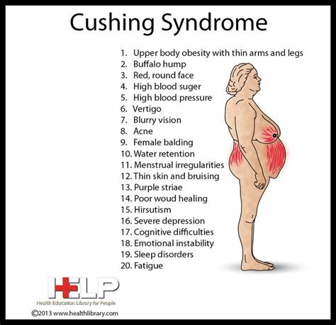 Medical surgical nursing, Surgical nursing, Cushings syndrome