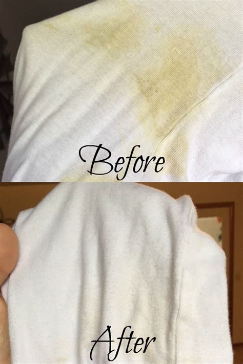 The Best Way To Remove Baby Poop Stains - Southern Dakota Mama