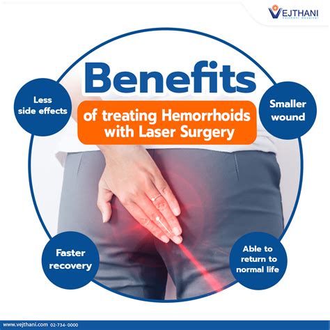 Benefits of Treating Hemorrhoids with Laser Surgery