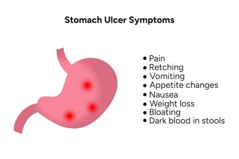 Premium Vector | Stomach ulcer symptoms