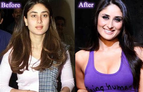 Kareena Kapoor before and after breast implants