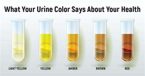 The Color Of Your Urine Tells A Lot About Your Health - Small Joys