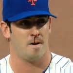 Nose Bleeds - Homeopathy For Athletes and Sports Injury