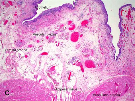 American Urological Association - Urinary Bladder: Lamina Propria