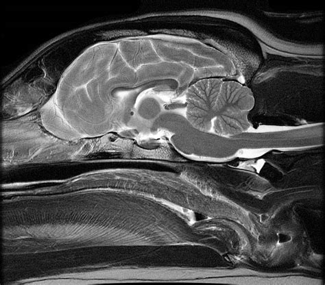 Sagittal Plane MRI Head Atlass