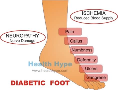 Untreated Diabetes Mellitus Consequences and Symptoms | Healthhype.com