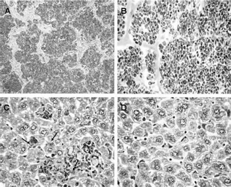 Histopathology of livers of mice infected with Sporothrix brasiliensis ...