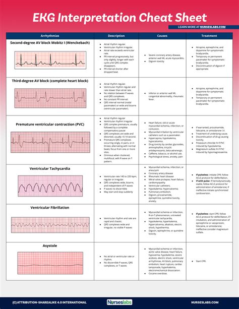 EKG Interpretation Cheat Sheet & Heart Arrhythmias Guide (2020 Update)