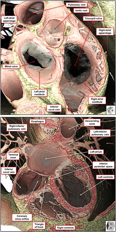 What is the real cardiac anatomy? - Mori - 2019 - Clinical Anatomy - Wiley Online Library