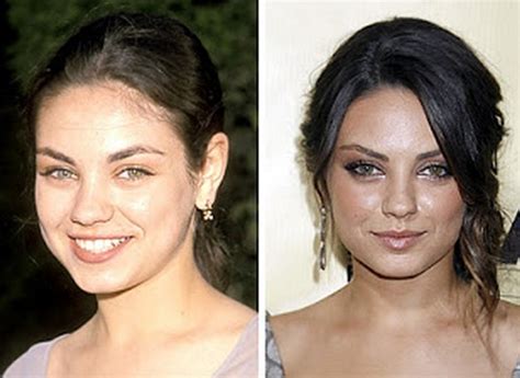 Mila Kunis Nose Job Plastic Surgery Before and After