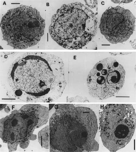 Electron microscopic morphology of K562 cells incubated for 48 h with ...