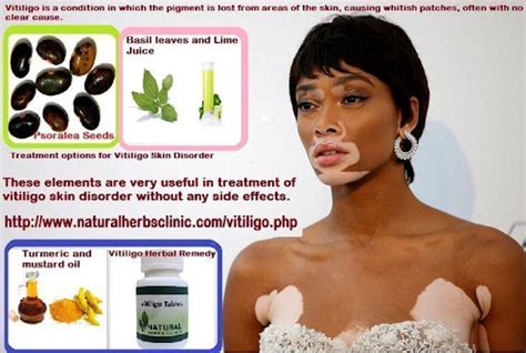 Other Natural Remedies: Vitiligo Treatment For Skin Depigmentation-Immunotrax Pi…