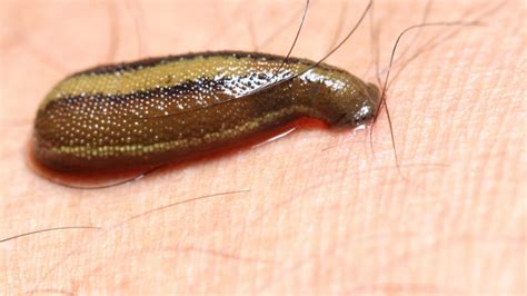 Using Leeches to Track the World's Rarest Animals