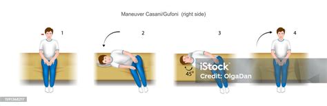 Casani Gufoni Maneuver Right Side Stock Illustration - Download Image Now - Alternative Therapy ...