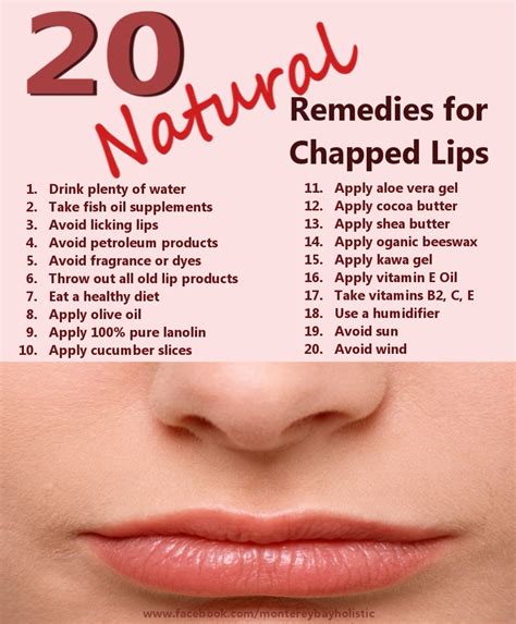 20 Remedies For Chapped Lips💋 - Musely