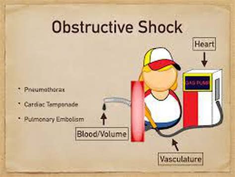 Symptoms of obstructive shock - MEDizzy