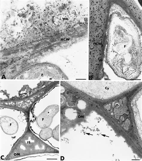 Transmission electron micrographs of Pythium oligandrum-inoculated... | Download Scientific Diagram