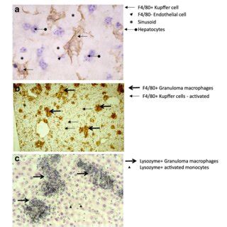 Kupffer cells, monocytes and macrophages interact with sinusoidal... | Download Scientific Diagram