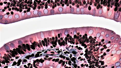 Mammalian Histology: Epithelial Tissues – Berkshire Community College Bioscience Image Library