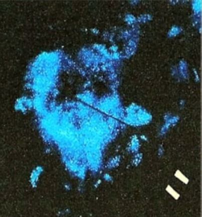 Very frightening luminol image of what is beleived to be Adam Walsh's ...