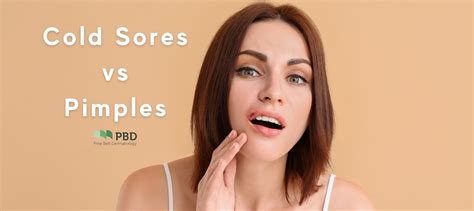 What Do Pimples On Your Lip Line Mean - Infoupdate.org