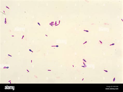 Clostridium Botulinum Gram Stain