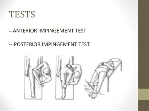 Femoro-acetabular impingement syndrome