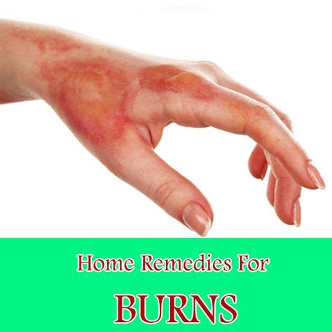 8 Best Home remedies for burns images | Home remedies, Home remedies ...