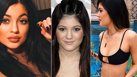 Plastic Surgeons Weigh In On Kylie Jenner's Dramatic Transformation—Did ...