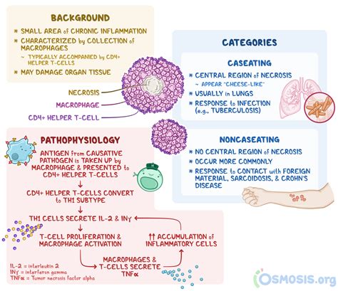 Granulomas: What Is It, Types, Causes, and More | Osmosis