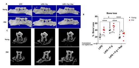 Alveolar bone loss as function of age and Pg-gavage. (A) Micro CT... | Download Scientific Diagram